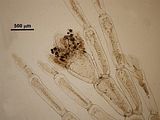 5 –  Ramo laterale bicellulare con tetrasporocisti sulla cellula subapicale